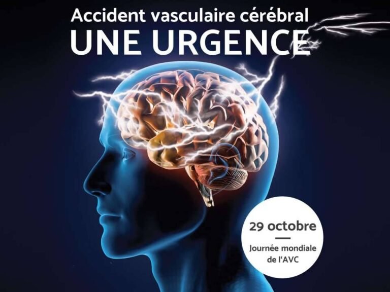 Journée mondiale de prévention de l&rsquo;AVC.